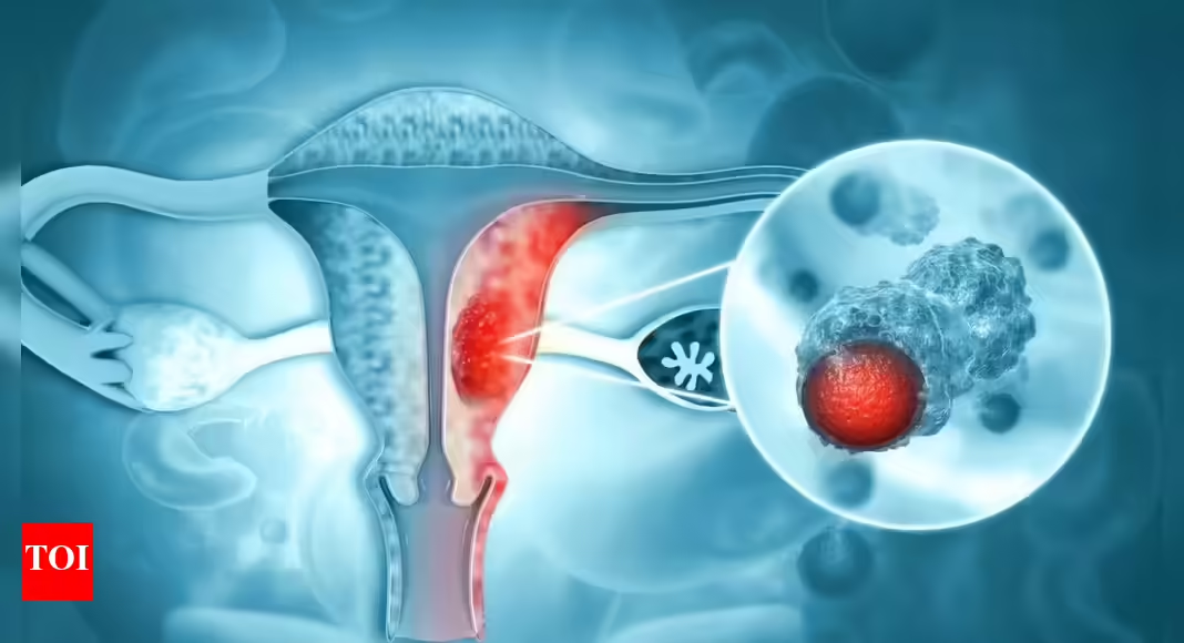 Microplastics in the Ovaries The New Crisis for Global Reproductive Health